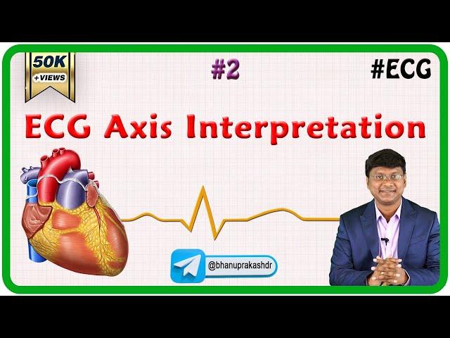 2. ECG Axis Interpretation - ECG assessment and ECG interpretation made easy