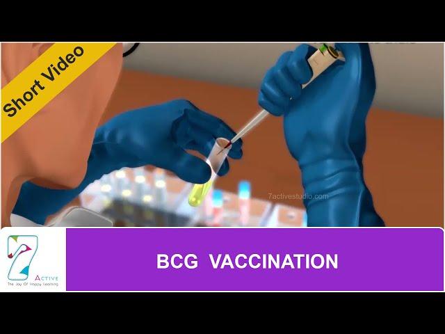 BCG VACCINATION