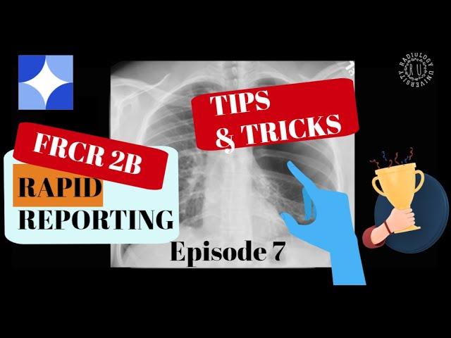 Episode 7: FRCR 2B Rapid Reporting (RR) tips and tricks