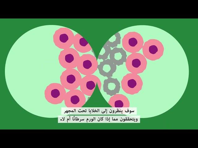 What is cancer? (Arabic) | ما هو السرطان؟ (العربية) | Macmillan Cancer Support