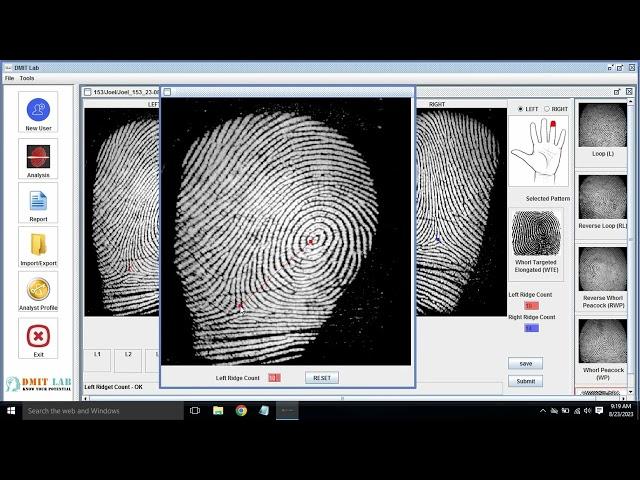 DMIT Software Demo Auto Ridge Count, DMIT LAB India