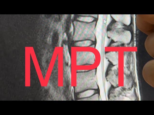 МРТ позвоночника - как выглядит грыжа спины. Магнитно-резонансная томография