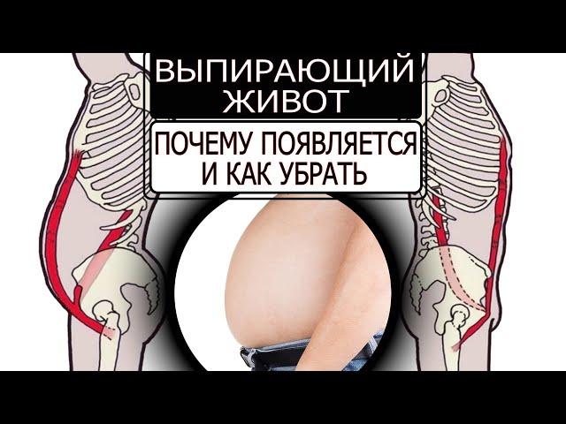 Выпирающий живот. Почему появляется и как убрать.