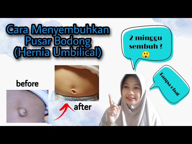 Pusar Bayi Sempat Basah, Berdarah, & Bernanah sampai Muncul Benjolan | Sembuh 100% 