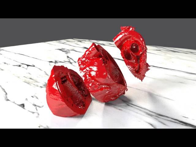 Transposition of the Great Arteries Congenital Heart Defect 3D Printing STL Files