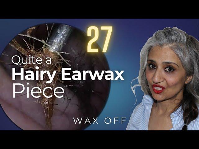 Quite a Hairy Earwax | Wax Off Episode 27