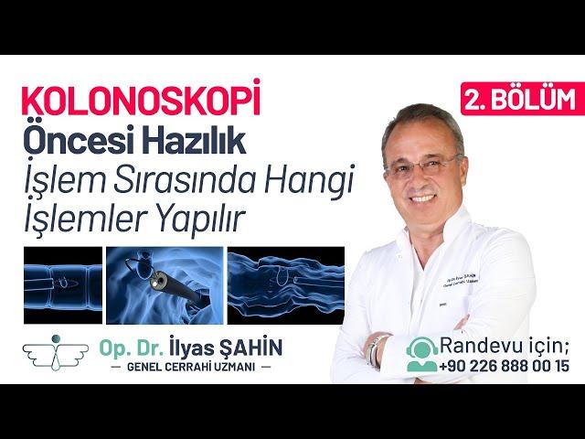 KOLONOSKOPİ İŞLEMİ ÖNCESİ HAZIRLIK - KOLONOSKOPİ İŞLEMİ SIRASINDA HANGİ İŞLEMLER YAPILIR?