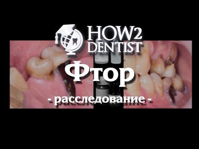 Как фтор работает против кариеса / How to Dentist