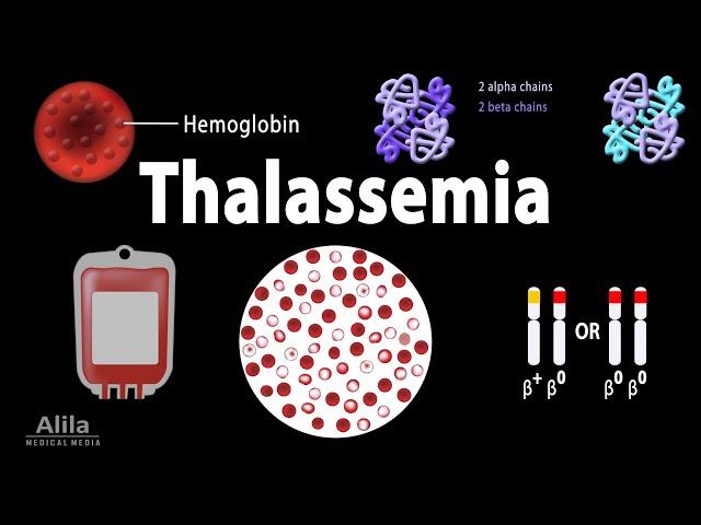 Thalassemia: Alpha & Beta-Thalassemias, Genetics, Pathophysiology, Diagnosis & Treatment, Animation