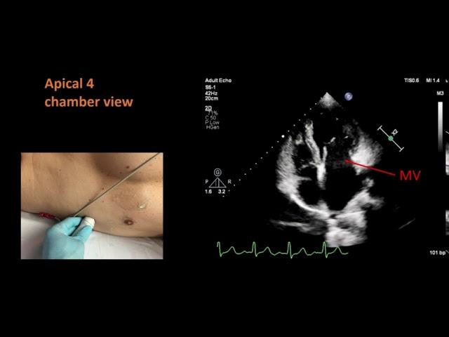 Standard views for a basic echocardiogram