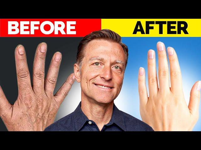 The Ultimate Hand Transformation – Dr. Berg's Best Remedy for Dryness and Wrinkles