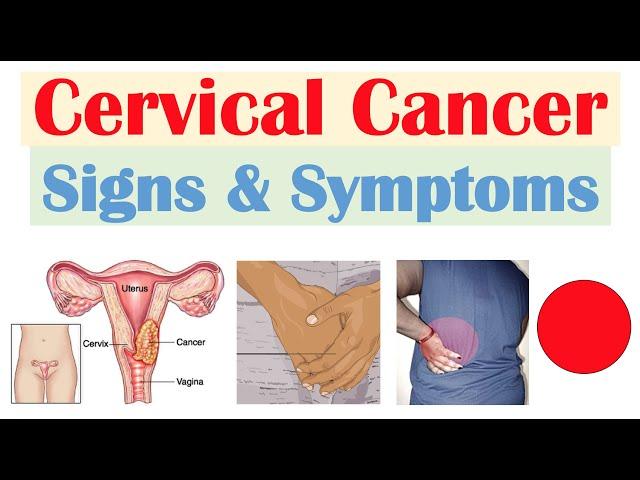 Cervical Cancer Signs & Symptoms (& Why They Occur)