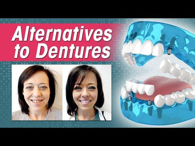 Alternative to Dentures: Comparing Dentures, Overdentures, All-on-4 and 3 on 6™