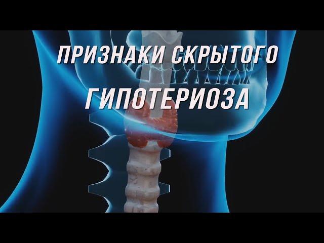 Признаки скрытого гипотериоза.  Келп.