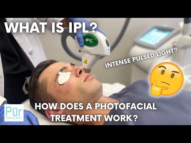 What is IPL? | How Does an IPL Intense Pulsed Light PHOTOFACIAL TREATMENT Work? | Pūr Skin Clinic