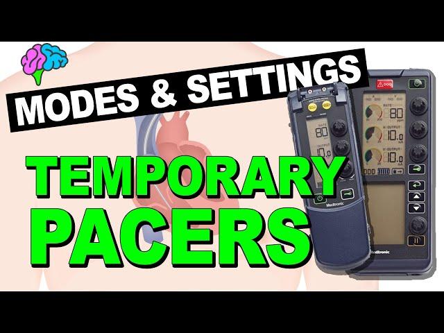 Temporary Pacemakers - Modes and Basic Settings