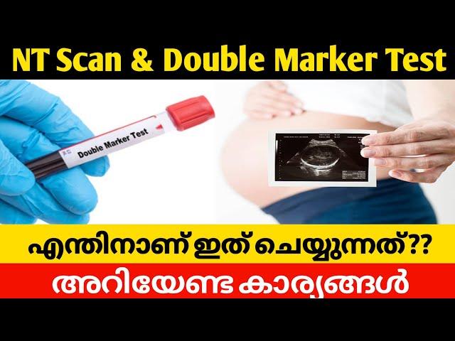 NT Scan In Pregnancy Malayalam | Double Marker Test | Pregnancy 3 Month Scaning Malayalam