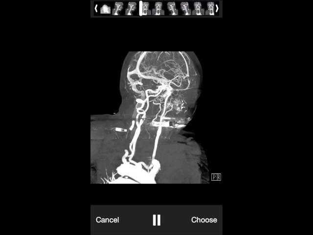 Converting DICOM to MP4 movie files: A proof of concept proposal.