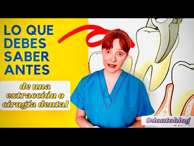 Cosas que debes de saber ANTES de que te hagan una extracción ó cirugía dental  PARA PACIENTES