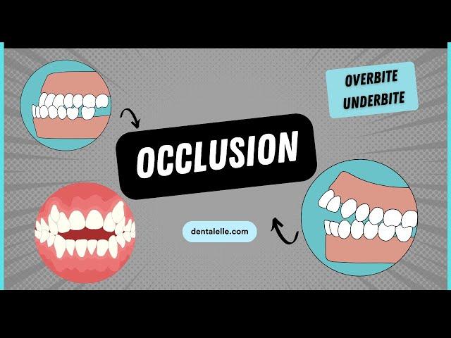 Explaining Dental Occlusion Types, Issues, and Treatments