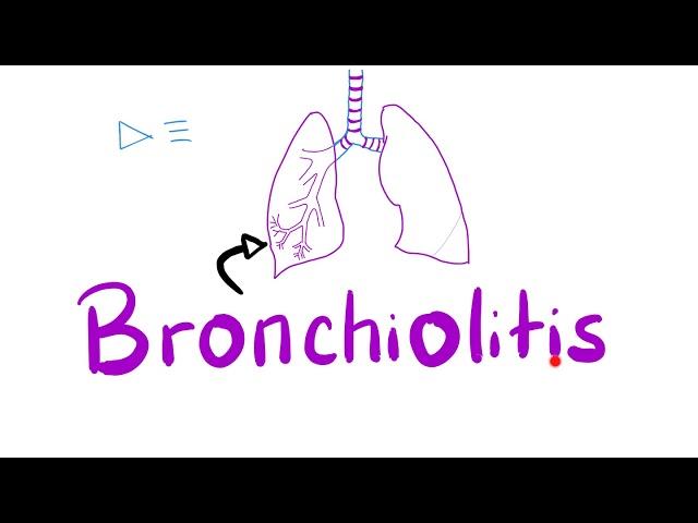 Acute Bronchiolitis, Bronchiolitis Obliterans-Organizing Pneumonia (BOOP) | Pulmonology