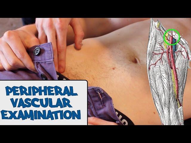 Peripheral Vascular Examination - OSCE Guide (old version) | UKMLA | CPSA