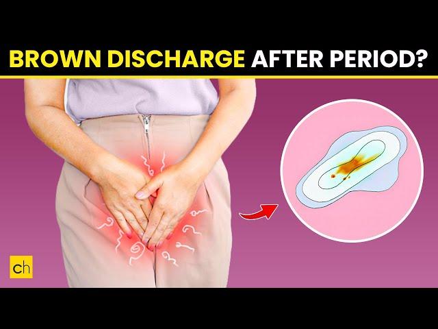 How To Stop Brown Discharge After Period - Causes & Natural Remedies