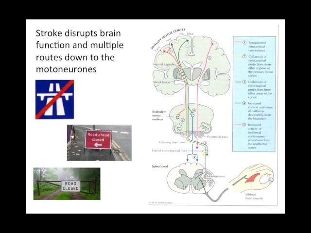 Dr Allie Turton - Stroke rehabilitation: The corticospinal tract and beyond