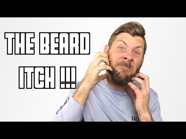 The Beard Itch | Problems & Solutions!!!