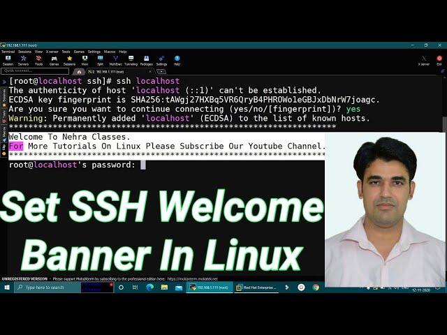 Set SSH Welcome Banner in Linux | How To Set Before & After SSH Welcome Banners in RHEL