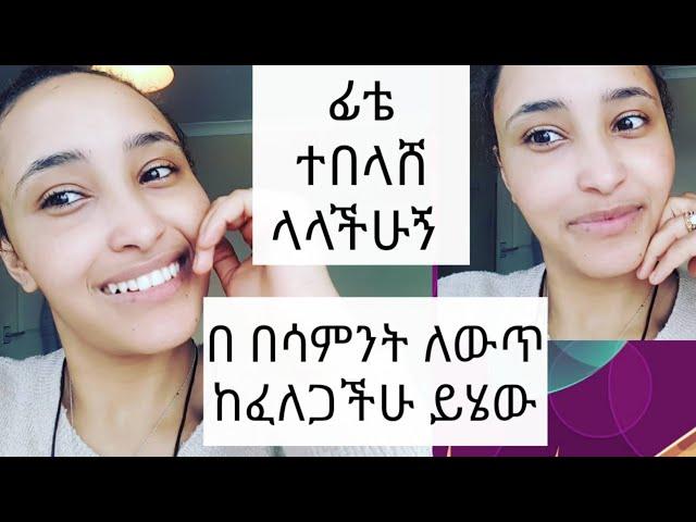 የፊቴ ሚስጥር ይሄው ሞክሩት  በሳምንት ለውጡን ታዩታላችሁ