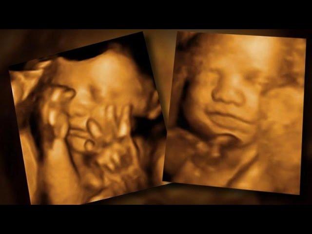 FDA warns against 3-D "keepsake" ultrasounds