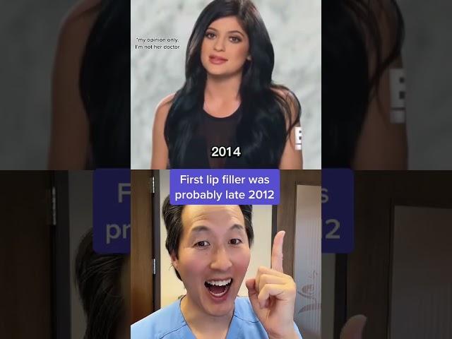 Kylie Jenner’s Plastic Surgery Over the Years- One Doctor’s Opinion #shorts #kyliejenner