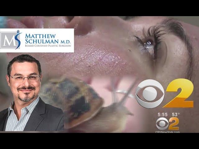 Dr Matthew Schulman Fancy Facials -  CBS 2 News New York - Schulman Plastic Surgery