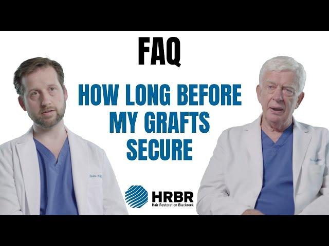 FAQ: How long after my hair transplant are my grafts secure? - Hair Restoration Blackrock