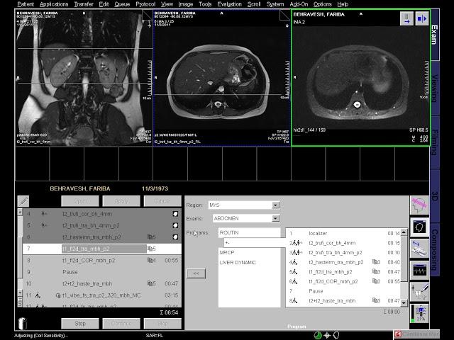 Adrenal Gland (Dynamic Study)