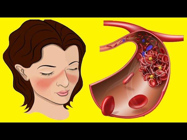 Thick Blood: Causes And Symptoms