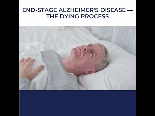 Uncovering the Reality of End-Stage Alzheimer's: How the Dying Process Unfolds ‍