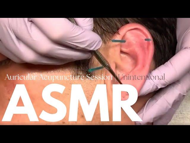 [ASMR] Auricular (Ear) Acupuncture Treatment | Real Person ASMR  ft. Tom