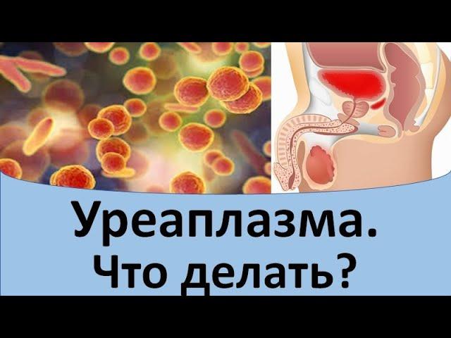 Уреаплазма.  Что делать?