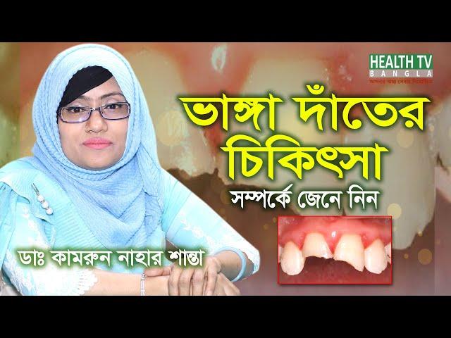 ভাঙ্গা দাঁতের চিকিৎসা | Broken teeth treatment | দাঁত ভেঙ্গে গেলে করণীয় | Bhanga Dater Treatment