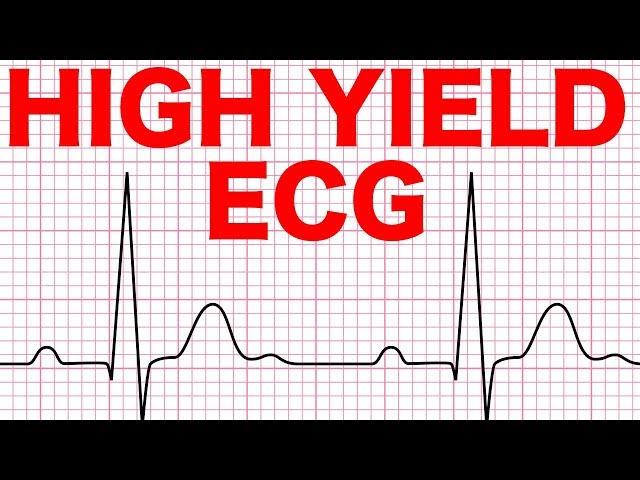 Electrocardiograms (ECG) Made Easy!