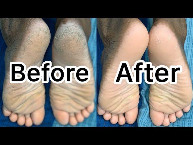 how to clean foot