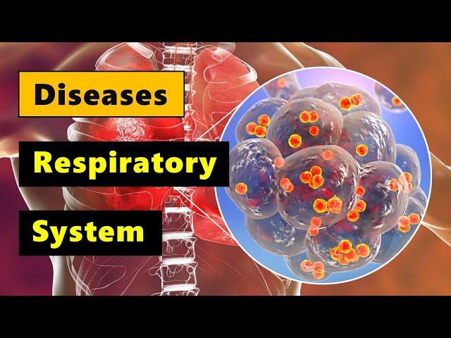 Diseases of the Respiratory System  I  Grade 9 - Q1 l PART 1