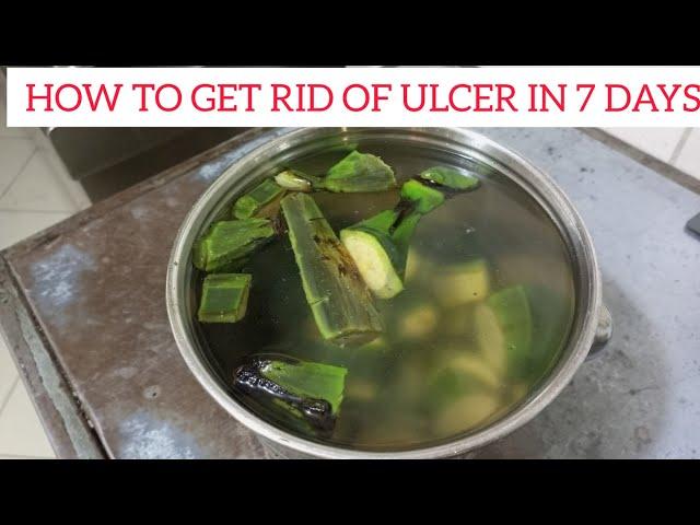 NATURAL HOME REMEDIES FOR ULCER SAY Goodbye TO ULCER