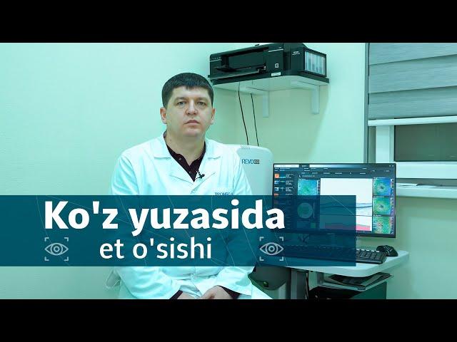 Ko'z yuzasida et o'sishi | Dr.zohidjon