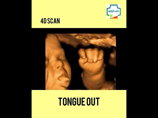 What is 3D and 4D Scan? | add-on Scans and Labs | Ultrasound Scan | Dr. Sunil Kumar G.S