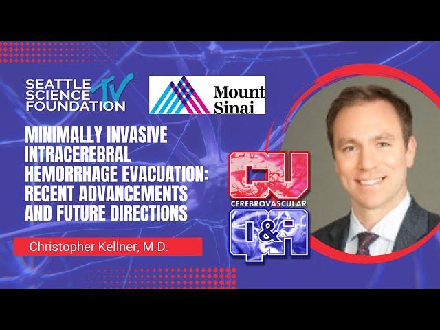 Minimally Invasive Intracerebral Hemorrhage Evacuation - Christopher Kellner, MD