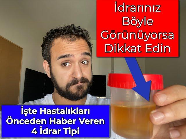 Hastalıkları Önceden Haber Veren 4 İdrar Tipi (Örnekleriyle)