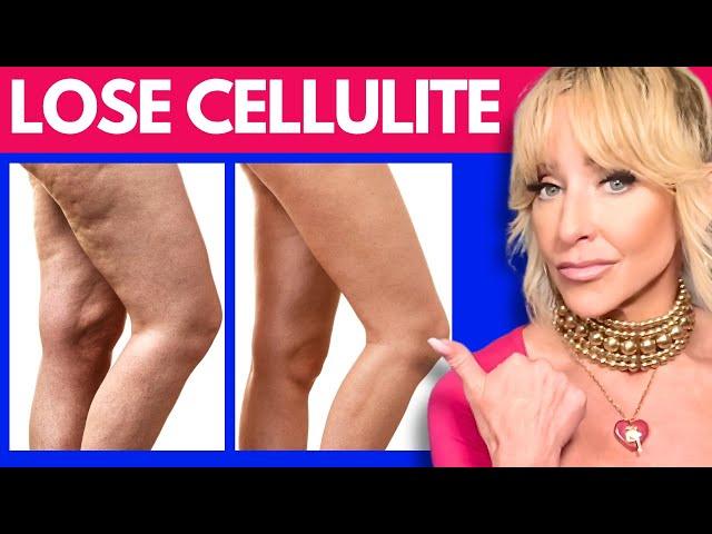 How To Get Rid Of Cellulite For Good | Science-Backed Ways